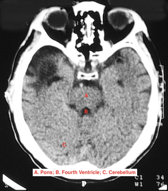 Cross Sectional Images Head My CT Registry Review